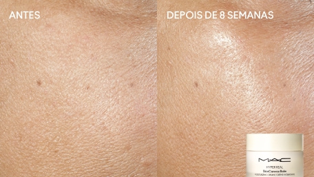 Antes e Depois
